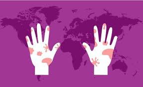 Imagen de apoyo de  Minsalud lanza cartilla para pacientes con lepra