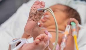 Imagen de apoyo de  El Instituto Nacional de Perinatologia brinda atencion integral a bebes prematuros