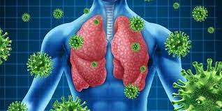Imagen de apoyo de  Prevencion de  infecciones respiratorias agudas IRA