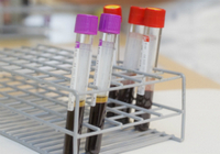 Imagen de apoyo de  Altos niveles de resistencia a los antibioticos en todo el mundo