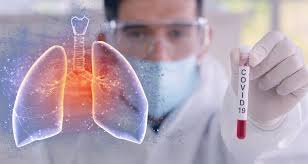 Imagen de apoyo de  Segun un nuevo informe de Eurasia Group se calcula que un acceso equitativo mundial a las vacunas de COVID19 podria generar US 153 mil millones de beneficios en 20202021 y US 466 mil millones para 2025