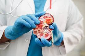 Imagen de apoyo de  Es invitada toda la poblacion a prevenir el cancer de rion que afecta principalmente a personas mayores de 50 aos