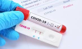 Imagen de apoyo de  Supersalud verifica procesamiento de pruebas COVID19 en los laboratorios