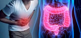 Imagen de apoyo de  El Hospital General de Mexico se consolida como referente en Enfermedad Inflamatoria Intestinal