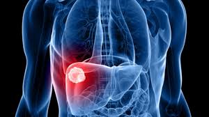 Imagen de apoyo de  Dia Mundial contra la Hepatitis impulsemos la eliminacion de la hepatitis B en las madres y sus hijos