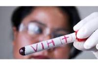 Imagen de apoyo de Casos de VIH en Bogota aumentaron un 23