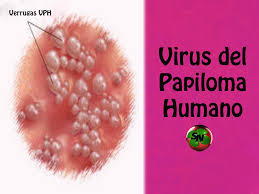 Imagen de apoyo de  Procuraduria se pronuncio ante la Corte Constitucional sobre tutela por caso de nia presuntamente afectada por la vacuna contra el Virus del Papiloma Humano VPH