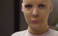 Imagen de apoyo de Tras un ao sin asistencia medica mujer quemada con acido inicio tratamiento gracias a tutela