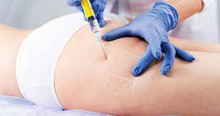 Imagen de apoyo de  La iniciativa legislativa a un paso de convertirse en ley es sin biopolimeros y sin victimas