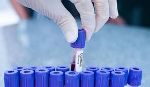 Imagen de apoyo de  La vacuna contra el COVID19 cada vez mas cerca de hacerse realidad no puede ser solo para los paises ricos