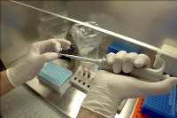 Imagen de apoyo de  Cientificos argentinos logran restaurar con celulas madre el labio leporino