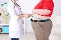 Imagen de apoyo de Corte Constitucional ampara derechos fundamentales de mujer con obesidad morbida y ordena a EPS Medimas practicar cirugia bariatrica