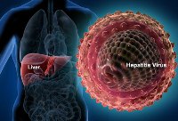 Imagen de apoyo de La hepatitis es una enfermedad que mata casi tanto como el sida asi lo anuncio la OMS